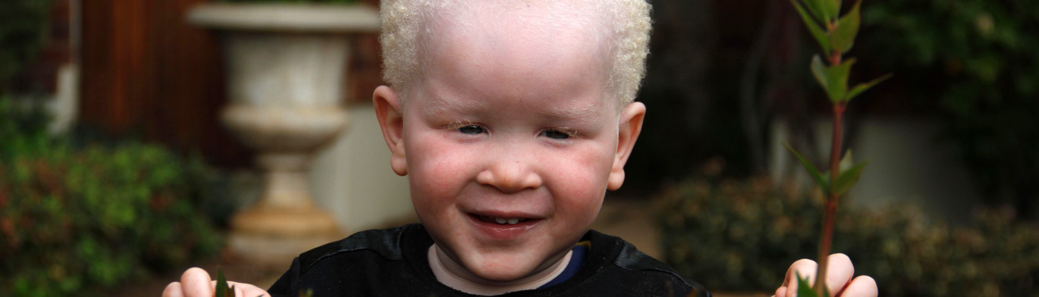 slider02 Education and support for congenital disorders community
